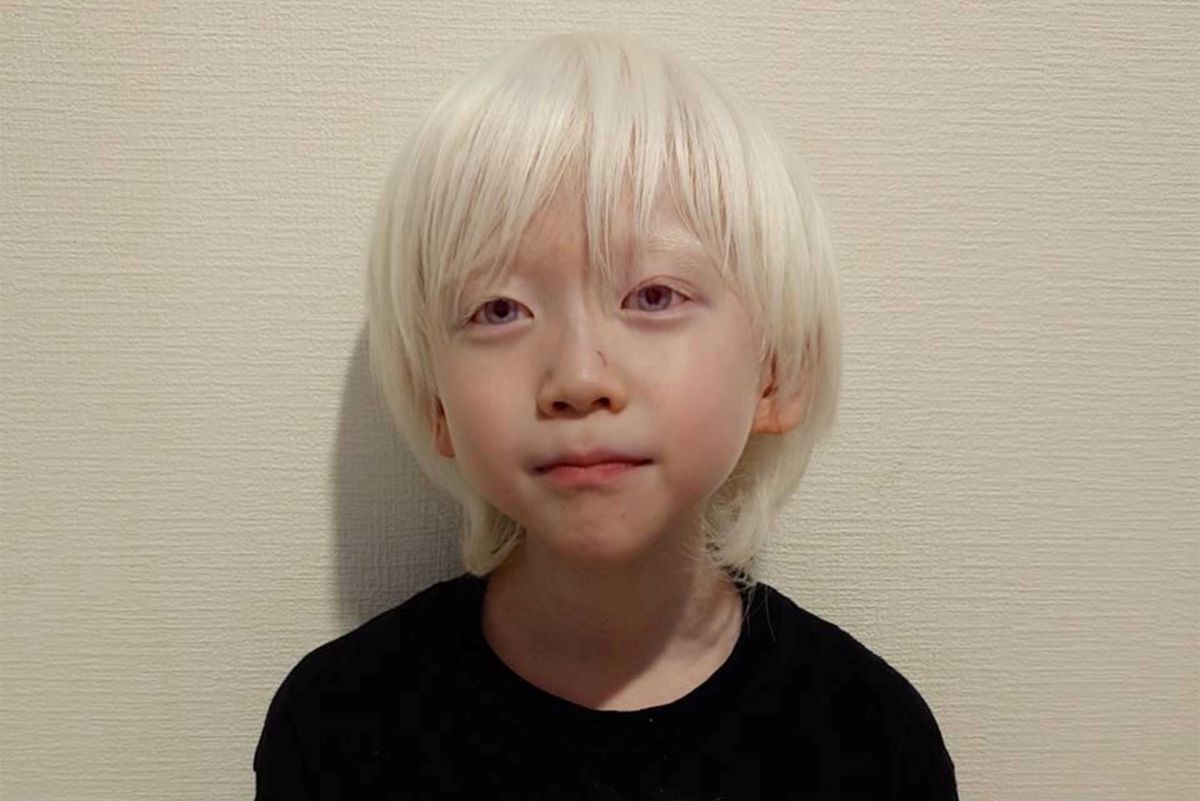 2万人の1人の指定難病『アルビノ』を抱える小学生のりっくん、母が語った息子への愛「個性は宝物」 | 週刊女性PRIME