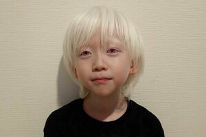 「アルビノ」を抱えているりっくん