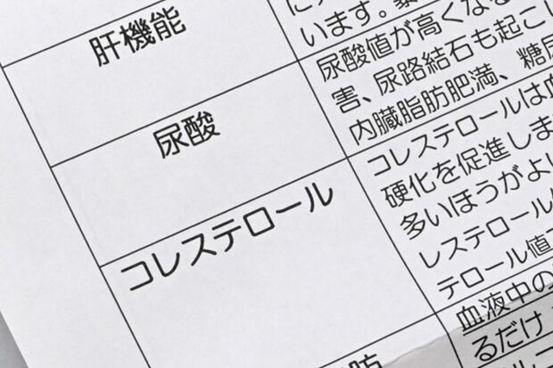 人間ドックには行かない