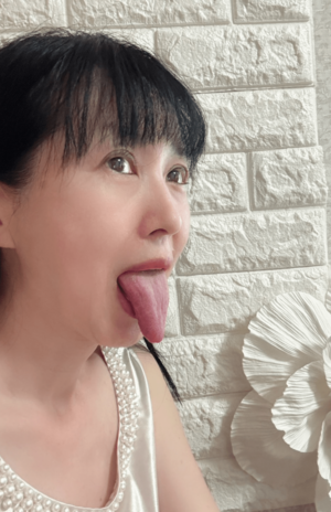 顎の骨格が小さいこと、そして舌が長いことが睡眠時無呼吸症候群の原因と指摘された西村さん。「舌が顎までいきますからね、長いんですよね……」