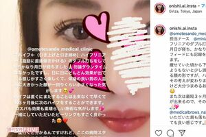 「ハイフ」などの美容技術によって、輪郭を綺麗にしたという愛さん