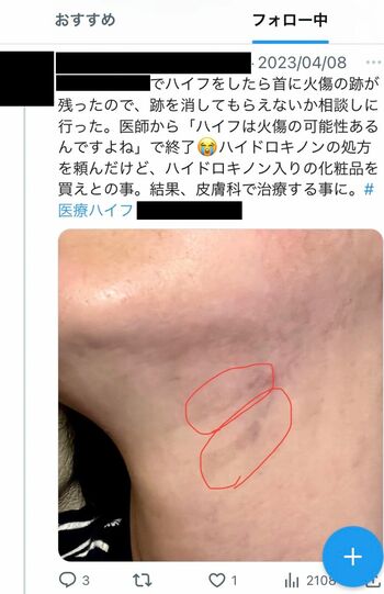 SNSでも被害の声が多数！