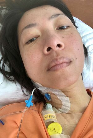 病院のベッドに横たわる財目かおりさん。腕よりもより心臓に近い首の太い静脈にルートを挿入して栄養を注入