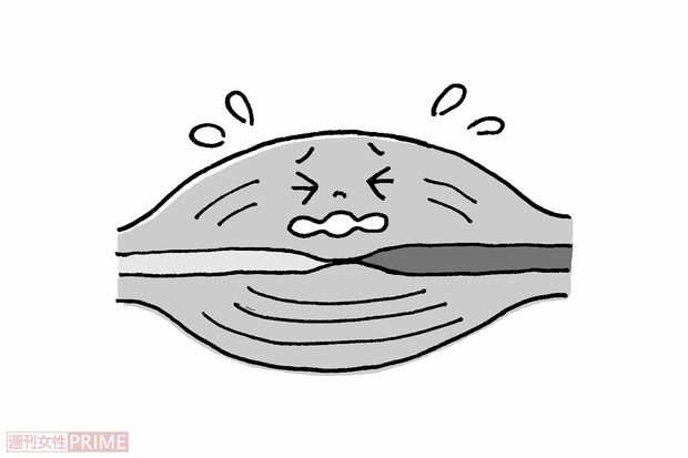 気持ちいいが 筋線維や血管に ダメージが（イラスト／伊藤和人）