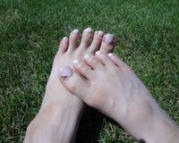 サンダルがはけない! アラ40のオンナを悩ませる足のトラブル