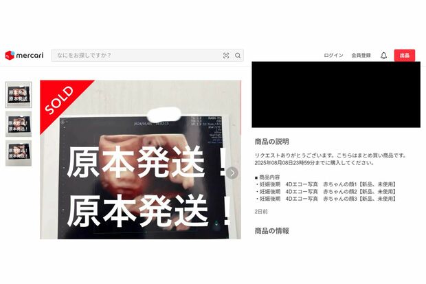 まとめ売りもされているエコー写真(メルカリより)