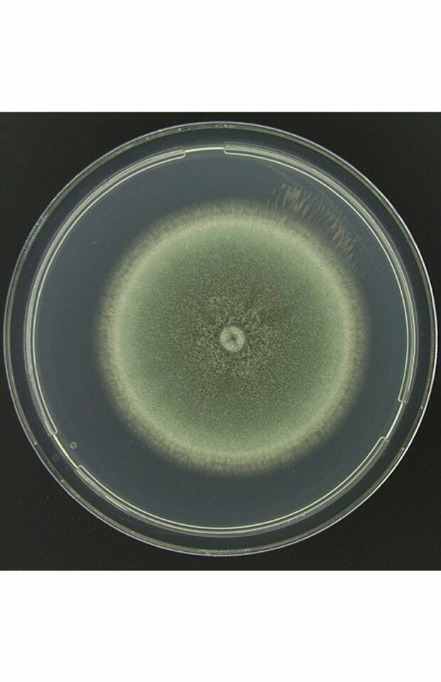 シャーレで培養したアスペルギルス菌。この菌が感染症の原因に　提供／千葉大学真菌医学研究センター