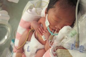 産後は呼吸もうまくできず、筋力も弱くミルクが口から飲めなかった富士くん