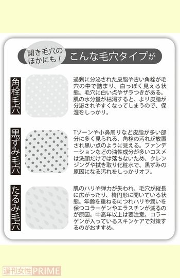 開き毛穴のほかにも！こんな毛穴タイプが