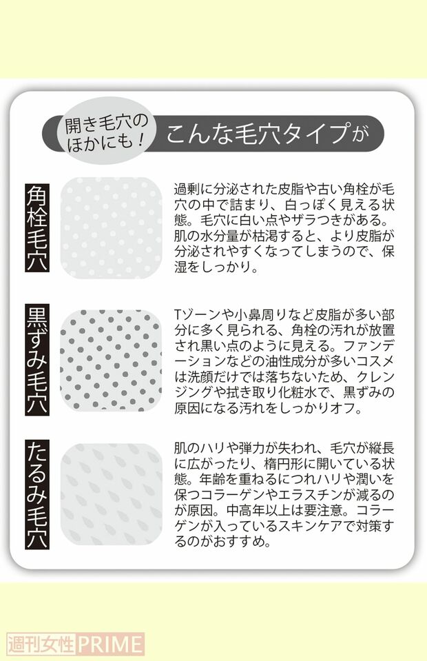 開き毛穴のほかにも!こんな毛穴タイプが