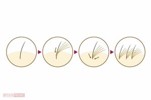 一本の地毛に数本のエクステをつけ、地下の根元に結合させることでボリュームがアップする