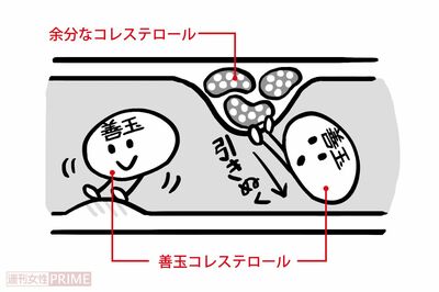 善玉コレステロールが血管を守る!(イラスト/上田英津子)