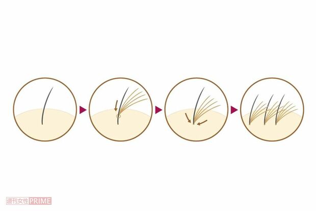 一本の地毛に数本のエクステをつけ、地下の根元に結合させることでボリュームがアップする