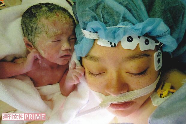 理解ある医師に出会い、31歳で長男を妊娠。さまざまなリスクがあったが、35週で無事に帝王切開で出産