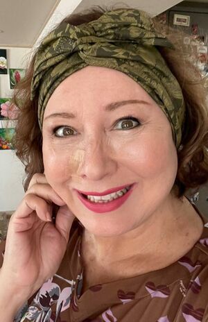 手術後16日目のキャシー中島さん。肌に近い色のテープで、しっかり保護してお化粧をするとだいぶ目立たなくなる