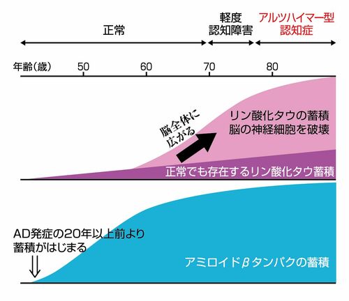 アミロイドβとリン酸化タウはAD発症に密接に関係している(監修/徳田隆彦教授 図/スヤマミヅホ)