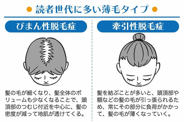 頭皮の夏バテ が秋に抜け毛を引き起こす 最新予防対策 治療法で薄毛に勝つ 週刊女性prime