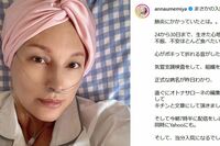 【独自】梅宮アンナ「いよいよ右胸とお別れ」乳がん手術前の“歯の準備”と術後の不安を本人に聞いた