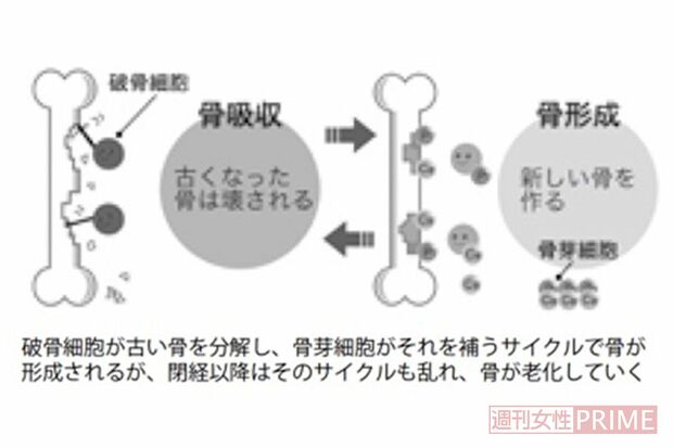 破骨細胞が古い骨を分解し、骨芽細胞がそれを補うサイクルで骨が形成されるが、閉経以降はそのサイクルも乱れ、骨が老化していく