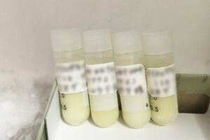 副作用がほとんどない、がん免疫療法