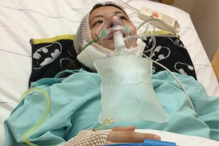 “500人に1人”の病「口唇口蓋裂」21回の手術を経た女性が得た生きる希望「今では私の代名詞」