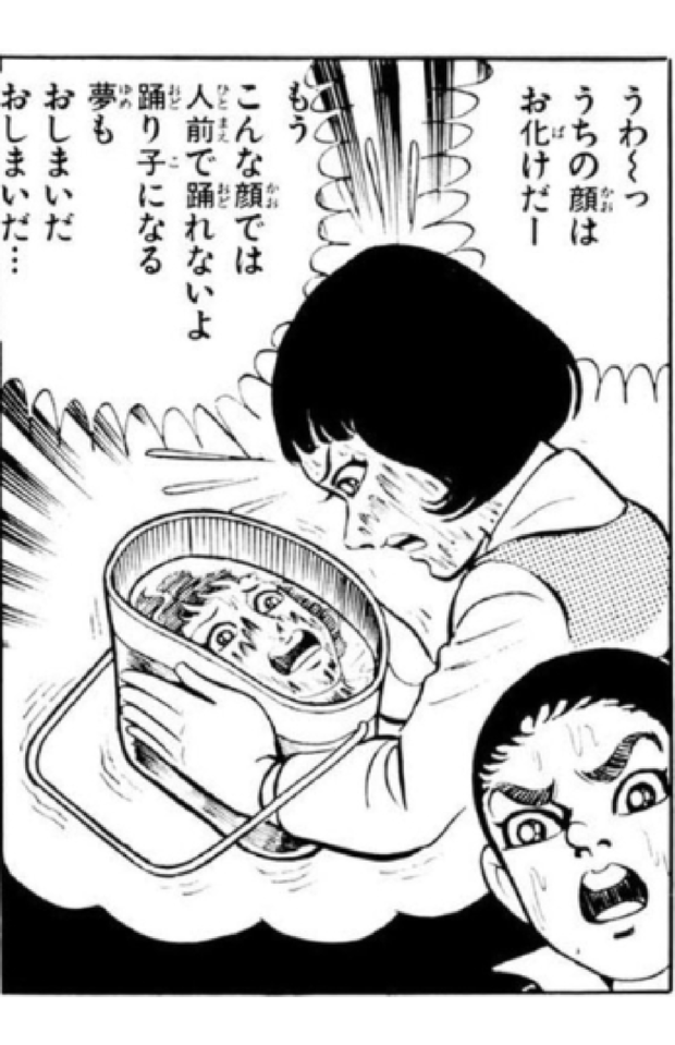 原爆から生き残っても顔にケロイドが残り、苦難の人生を歩む少女(『はだしのゲン』第6巻(汐文社))