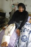 ガザの封鎖解除を求める抗議デモで負傷した女性(プライバシー保護のため一部編集しています)