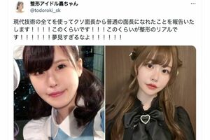 ネット上で反響を呼んだ整形アイドル轟ちゃんがSNSに投稿した“ビフォーアフター”（本人のXより）