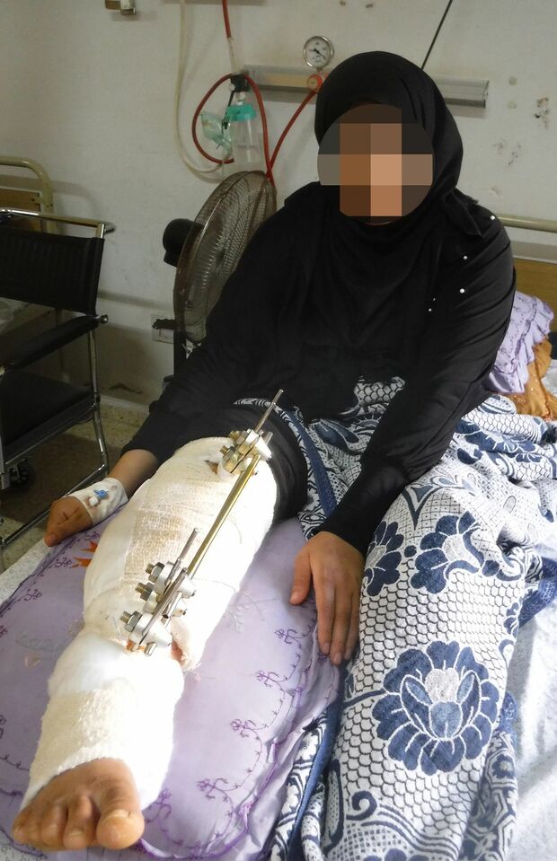 ガザの封鎖解除を求める抗議デモで負傷した女性（プライバシー保護のため一部編集しています）