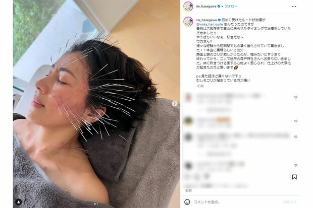 ルート治療を受けたことを報告した長谷川理恵(本人インスタグラムより)