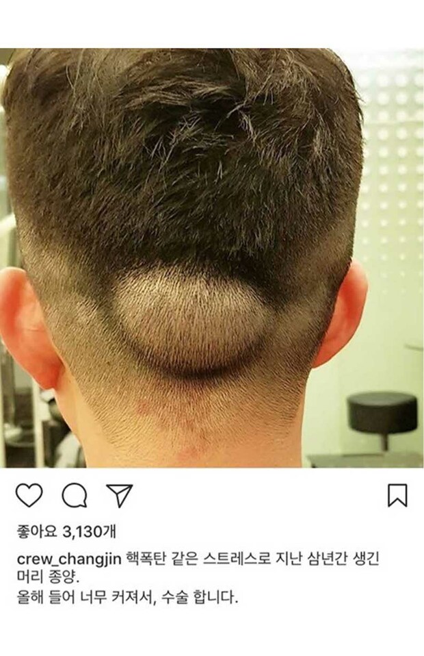 「ナッツ・リターン」事件の被害者だったパク・チャンジン前チーフパサーは、深刻なストレスで頭に腫瘍ができて、2014年12月に手術を受けていた（本人のSNSより）