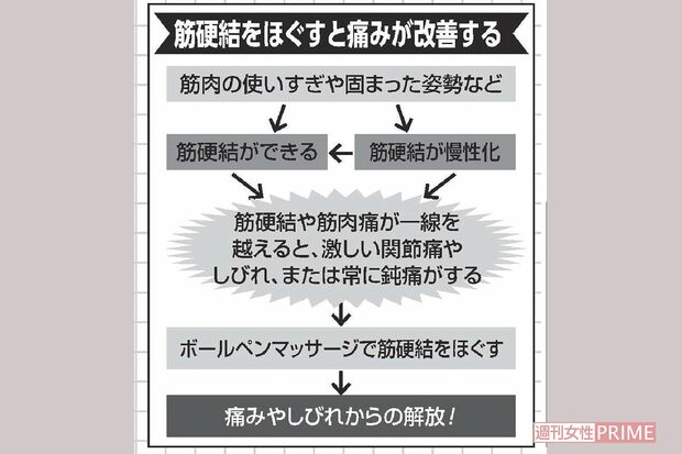 筋硬結をほぐすと痛みが改善する