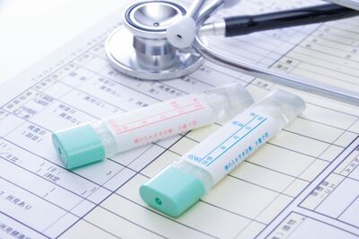 大腸がん検診（便潜血検査）は、大腸がんの早期発見に有効な検査。「陽性になったら必ず精密検査を受けてほしい」