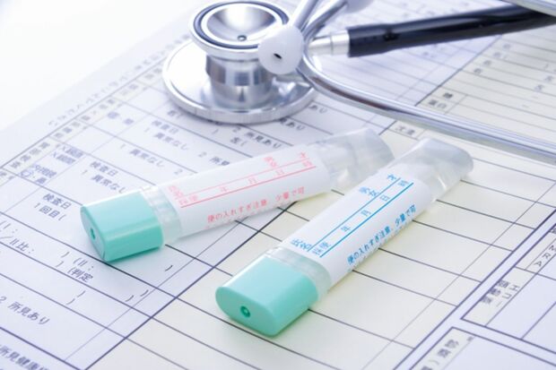 大腸がん検診（便潜血検査）は、大腸がんの早期発見に有効な検査。「陽性になったら必ず精密検査を受けてほしい」