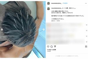 “ルート治療”を受ける窪田正孝。過激すぎるため、一部写真が“不適切なコンテンツ”扱いに（本人インスタグラムより）