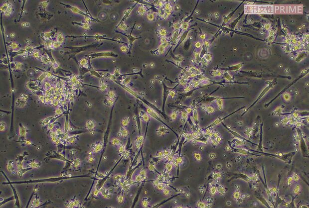 培養6日目の免疫細胞の様子。厚労省の基準に準拠して精製された免疫機能活性物質を投入して、さらに培養