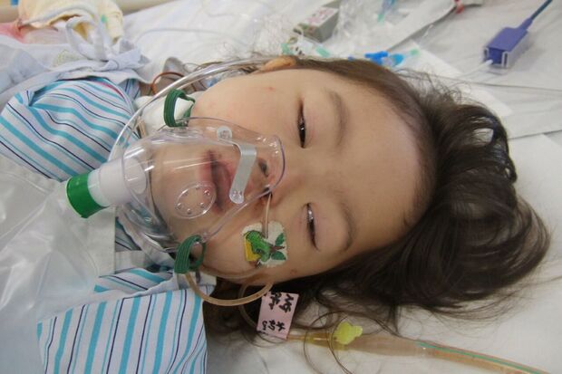 静岡県立こども病院で、食道の手術をした2日後の菜桜さん（当時3歳）（写真は本人提供）