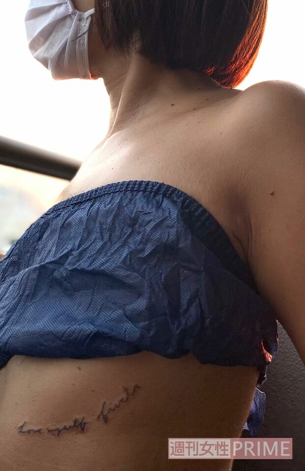 胸を切除したあとも、おしゃれな下着やトップスを身につけありのままの自分を楽しむ