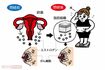 乳がんを大きくする女性ホルモンは閉経後は皮下脂肪でつくられる!