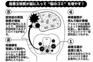 口内で発生した毒素が脳へ移動していく（イラスト／武曽宏幸）