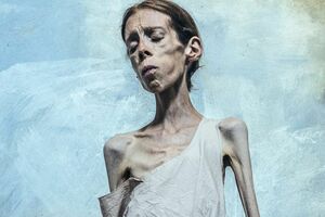 拒食症の写真家、レネ・マリー・フォッセン。先月、NHKのEテレで特集番組が組まれ、反響を呼んだ