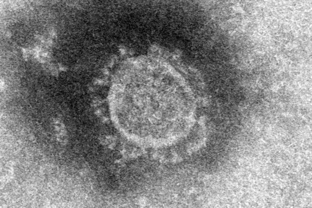 国立感染症研究所が撮影した新型コロナウイルスの電子顕微鏡写真