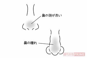 不自然な腫れ イラスト/石崎伸子