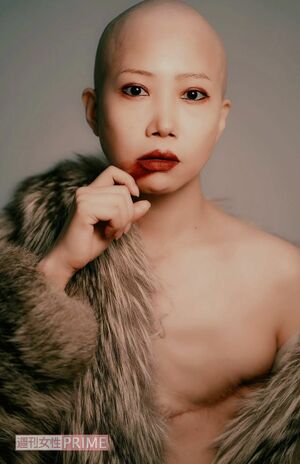 乳がんによる左胸の全摘手術後に撮影。「ありのままの自分」を表現した一枚　写真提供／ミワユータさん