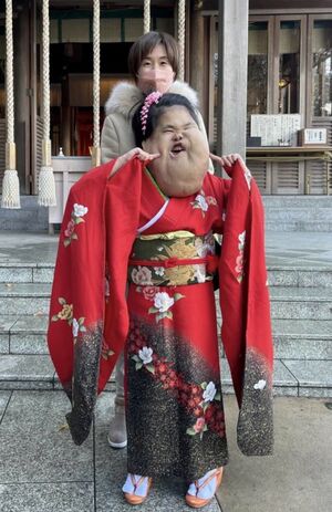 19歳、女性。呼吸困難や骨病変による痛み、骨折などが症状とされる、リンパ管腫。普段の洋服でさえ、着るのが大変なものもある中、着物なんてもっと無理と諦めていたところ、「こころ」の着物に出合い、チャレンジしてみたいと思ったのが依頼のきっかけ