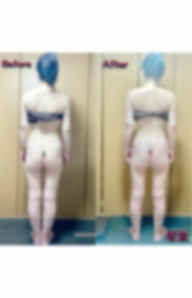 施術の実績報告では女性客のきわどい画像を公開していた（6/6）