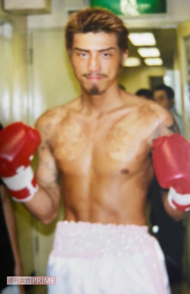 現役時代の大嶋さん。胸部は入れ墨を消した痛々しい後が残る