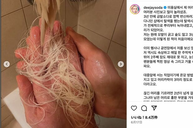 髪が抜けたことを報告した韓国のDJ SODA(本人の公式インスタグラムより)