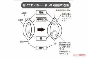 乾いてたるむ……哀しき外陰部の加齢