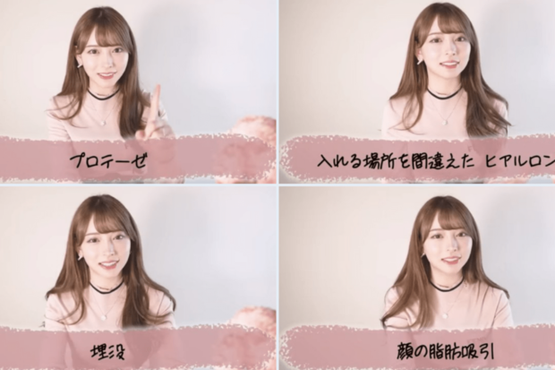 後悔した整形を語る黒崎みささん（Xより）